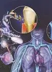 Illustration showing the connection between periodontal disease and other chronic conditions