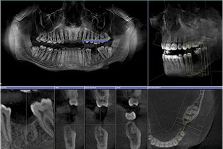 3D cone beam scanner images