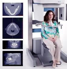 i-CAT scanner and images
